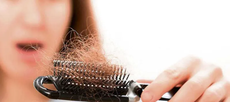 Caduta dei capelli? Ecco cosa fare, soluzioni e consigli "Occhio all’alimentazione"