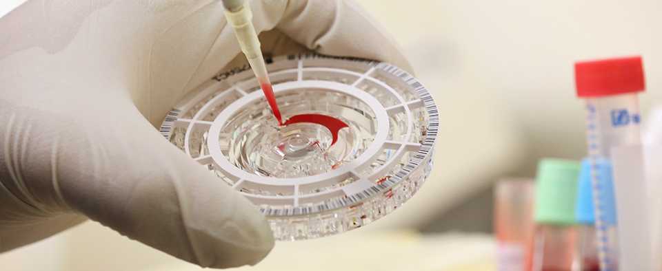 Coronavirus: due cure sperimentali, 'ha funzionato la terapia del plasma'