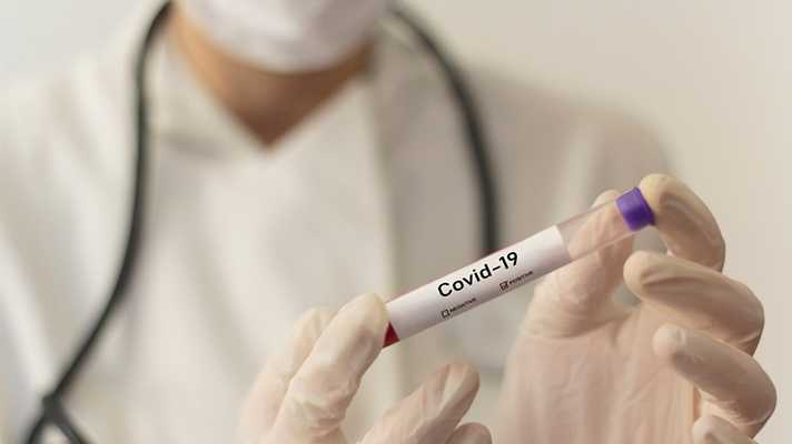 Coronavirus test Covid-19 rapidi a tutti e riavvio in 3 fasi
