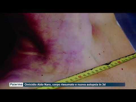 Omicidio Aldo Naro, corpo riesumato e nuova autopsia in 3D