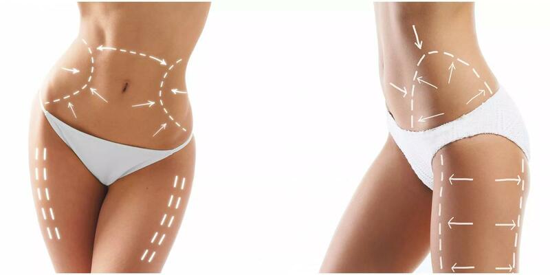 Perdere peso nei punti giusti: è possibile?