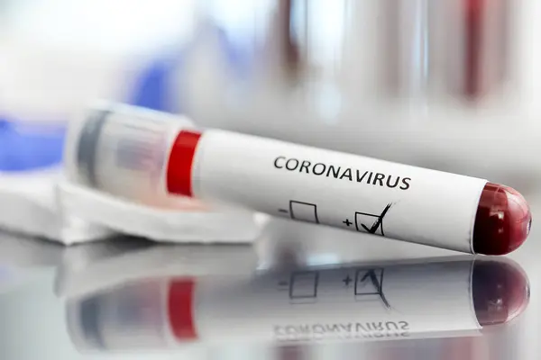 Coronavirus: in flessione aumento casi in Calabria, +12