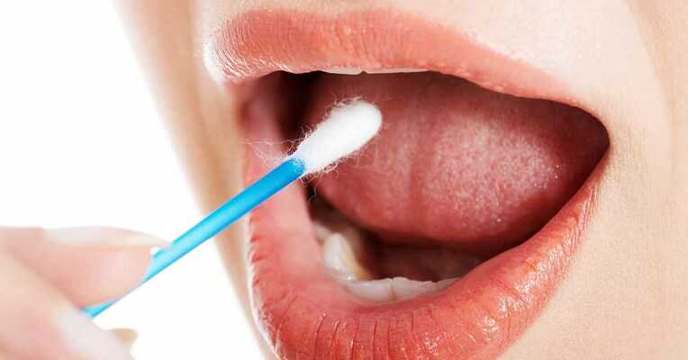 Spallanzani, con test saliva difficile screening rapido