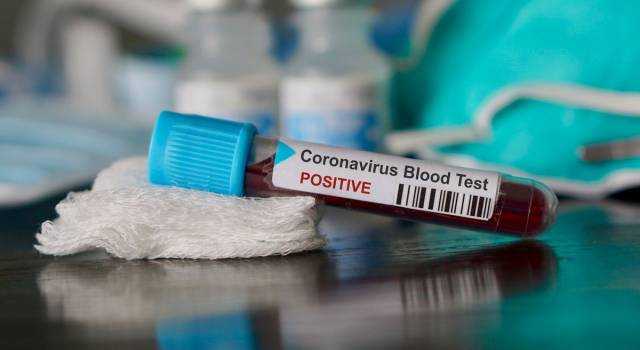Coronavirus: record di contagi, +16.079 in 24 ore. Aumentano anche i morti