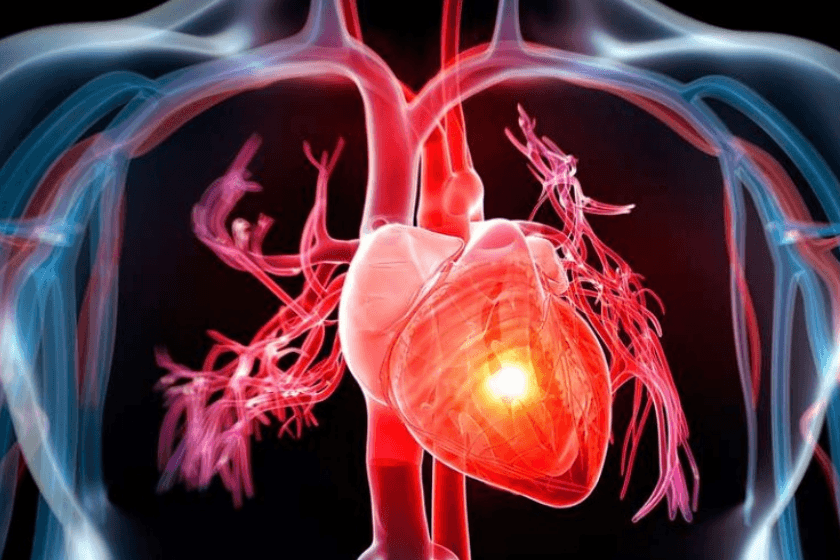 Cardiologi, evitabili 40mila morti anno per scompenso cardiaco