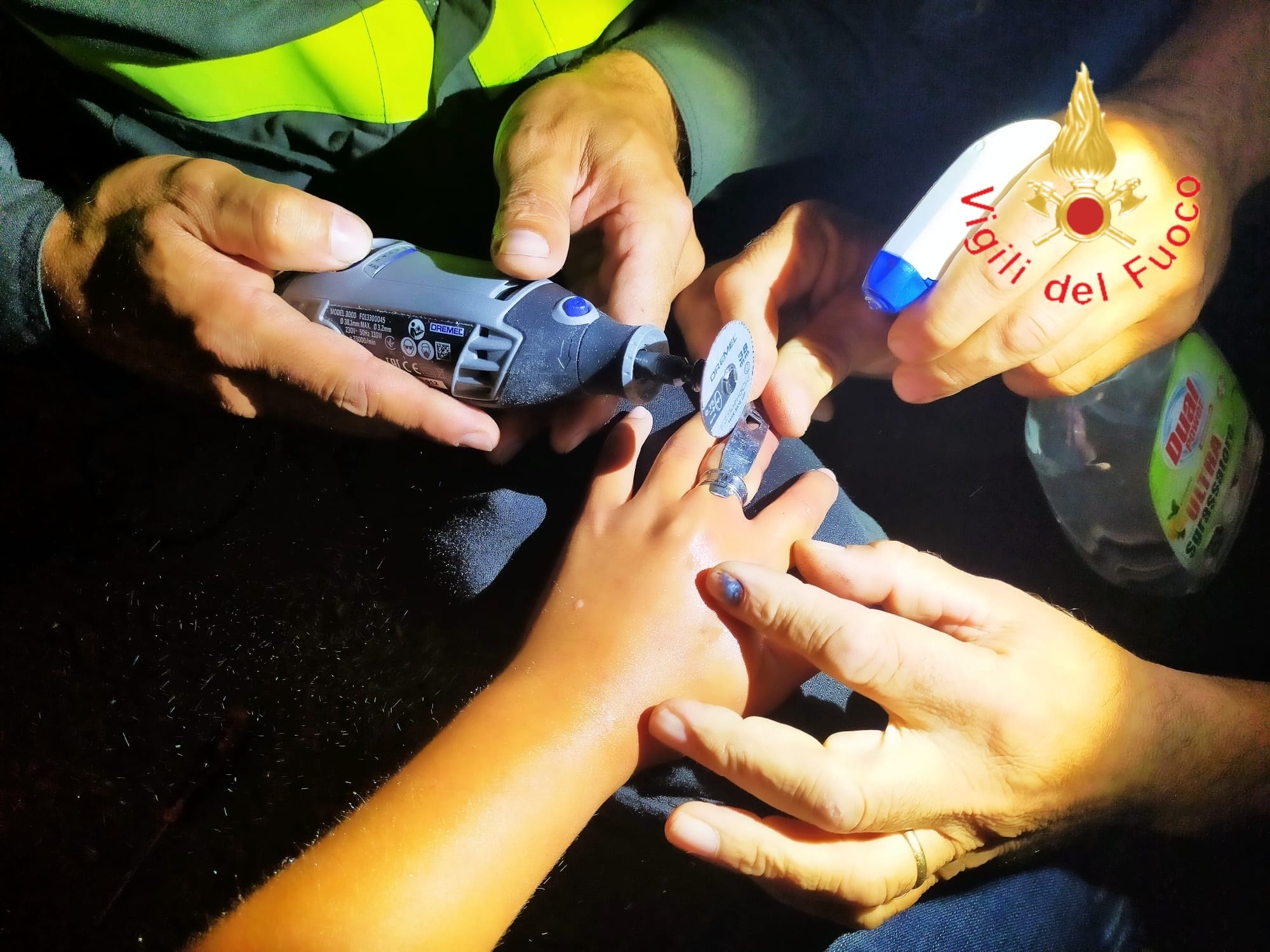 Bambino con anello incastrato in un dito: per “sfilarlo” delicatamente intervengono i Vvf. (Foto)