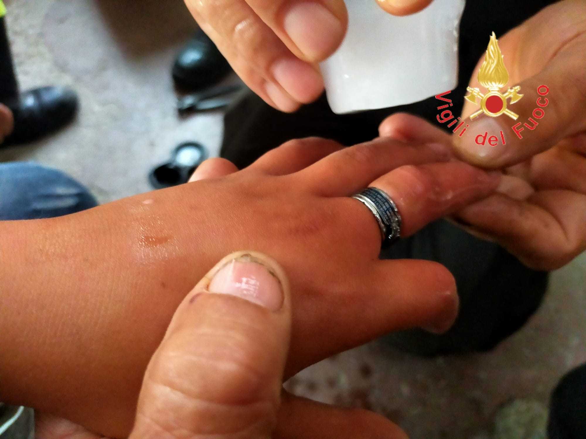 Bambino con anello incastrato in un dito: per “sfilarlo” delicatamente intervengono i Vvf. (Foto)
