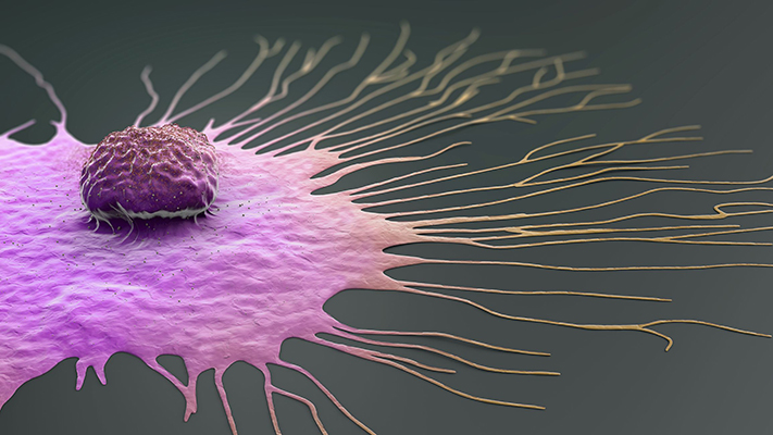 Salute. Tumore seno, scoperta una delle chiavi a resistenza farmaci. "Passo verso nuove cure"