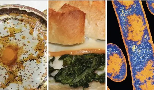Morto dopo un panino a Diamante: sospetto botulino, emergono audio e polemiche sui ritardi nelle indagini