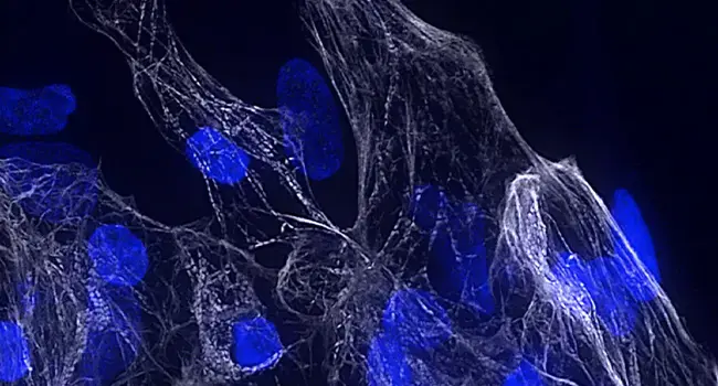 Scoperto un gene chiave per la salute del cuore