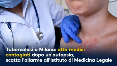 Tubercolosi a Milano: otto medici contagiati dopo un'autopsia, scatta l'allarme all'Istituto di Medicina Legale