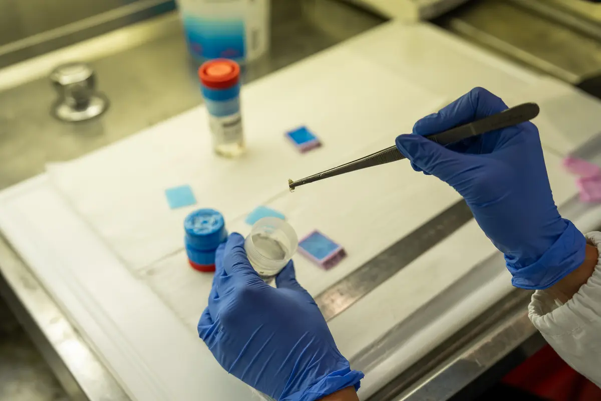 Ospedale San Carlo di Nancy porta la trasformazione digitale nel laboratorio di Anatomia Patologica